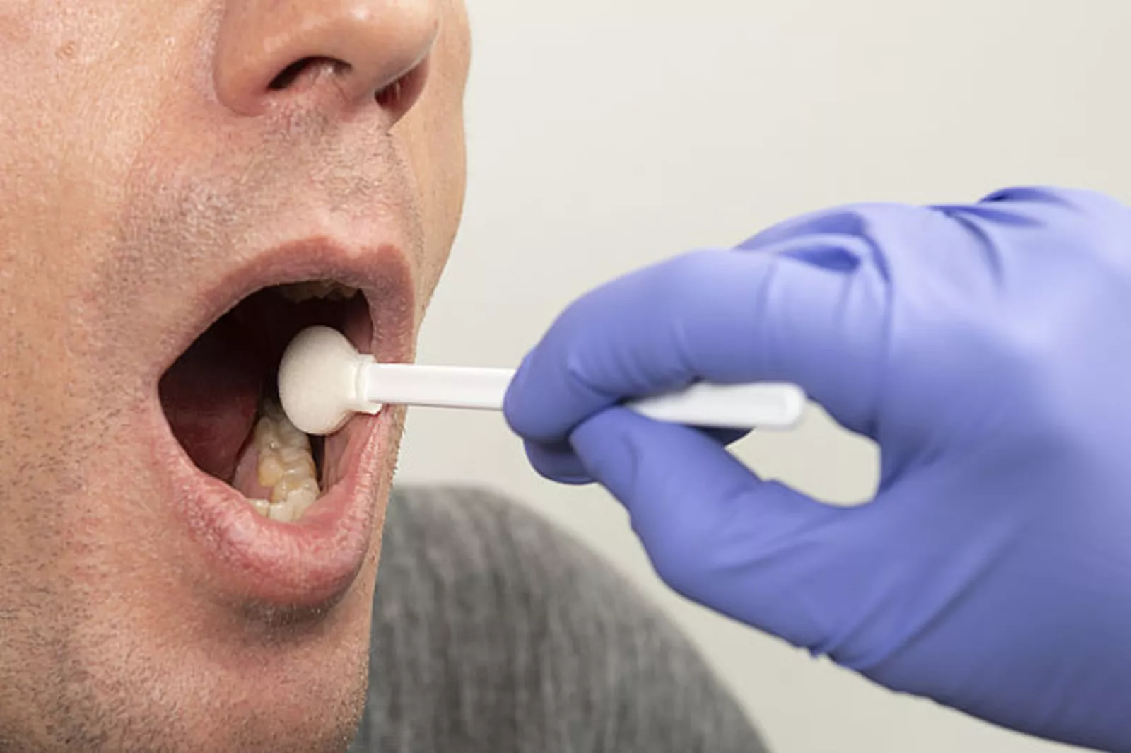 Photo d'un homme qui ouvre la bouche et une main gantée l'examine avec un bâtonnet blanc